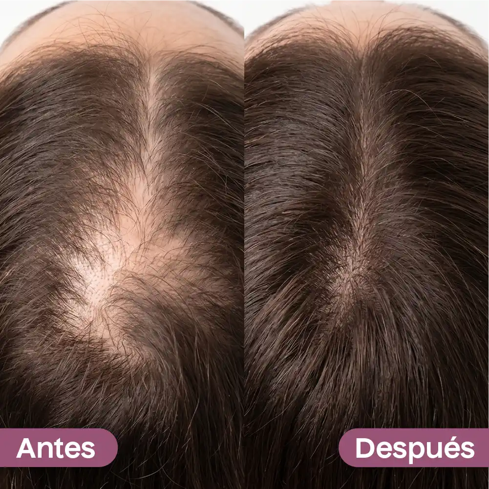 Kit Crecimiento Intensivo Kaba (5 Productos)