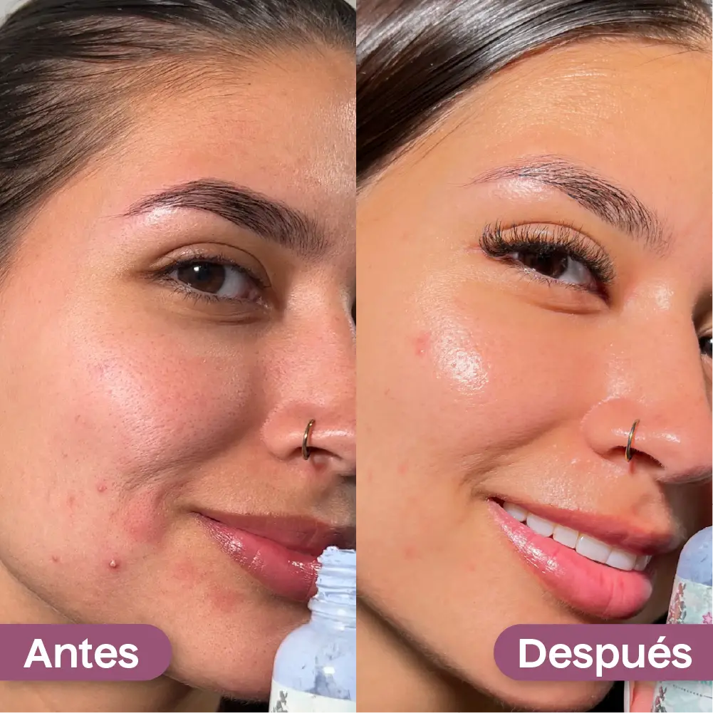 Loción Astringente Kaba 30 mL /1 Oz