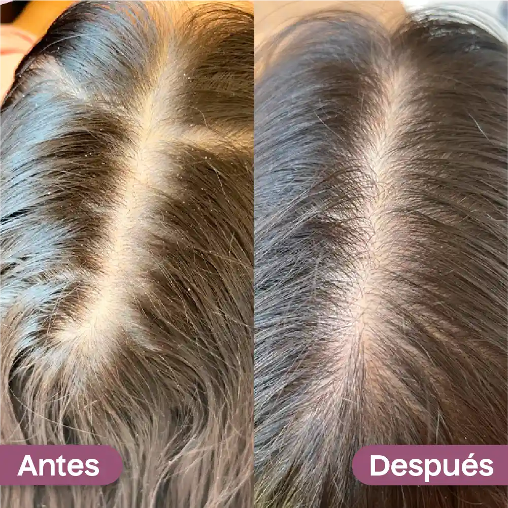 Tónico Capilar Crecimiento Intensivo  Kaba 30 mL